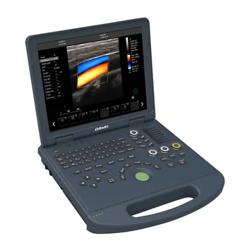 Ecografo portatil ultragarsas 15 LED nešiojamas nešiojamas spalvotas doplerio ultragarsas